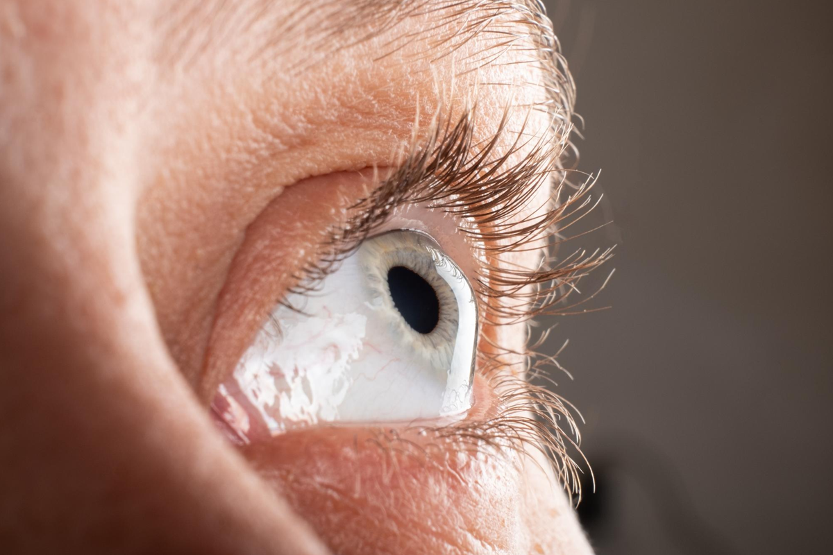 Cornea Treatment Cornea Transplant Treatment in Undri, Pune