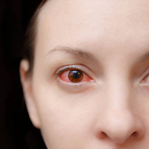 Symptoms of Diabetic Retinopathy