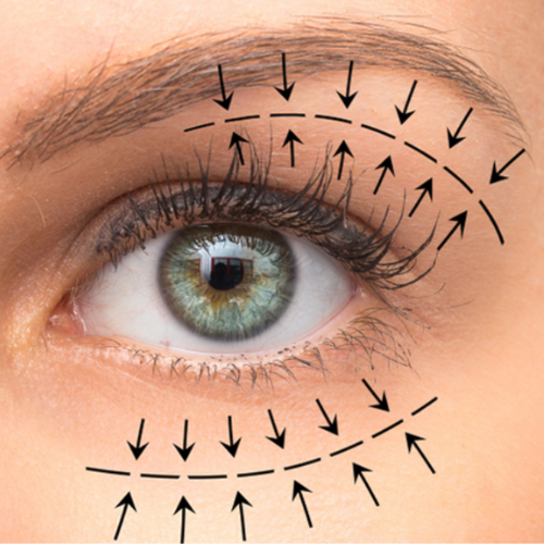 oculoplastic surgery