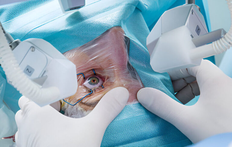 Advantages & Limitations of Laser Cataract Surgery