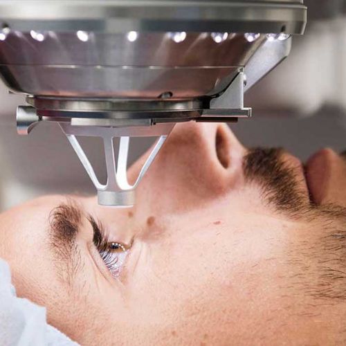 Femto Laser Cataract Treatment in Nanded - Motewar Netralaya