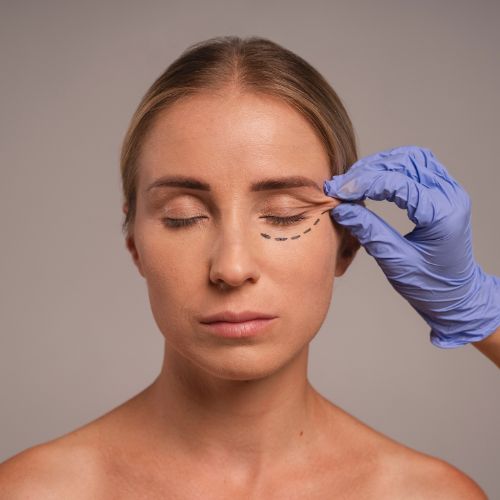 Oculoplasty Surgery at Motewar Netralaya