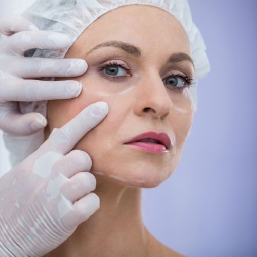 Oculoplasty at Motewar Netralaya