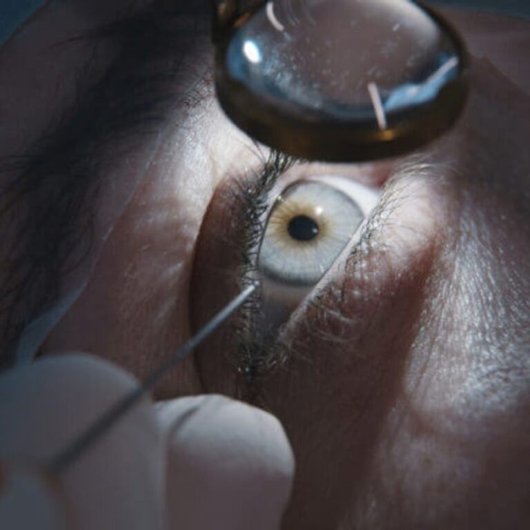 What to Expect: The Procedure & Care