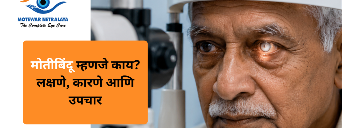 मोतीबिंदूमुळे धूसर झालेला डोळा – मोतीबिंदू म्हणजे काय याची माहिती, मोतेवार नेत्रालय नांदेड