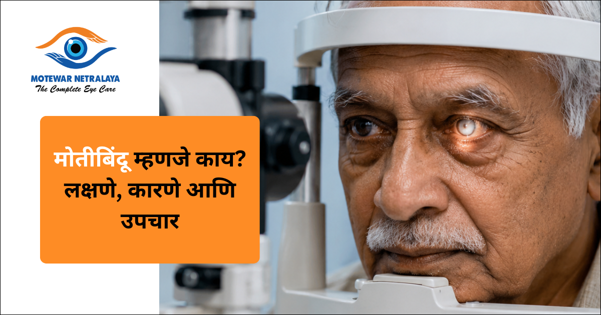 मोतीबिंदूमुळे धूसर झालेला डोळा – मोतीबिंदू म्हणजे काय याची माहिती, मोतेवार नेत्रालय नांदेड
